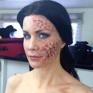 On set